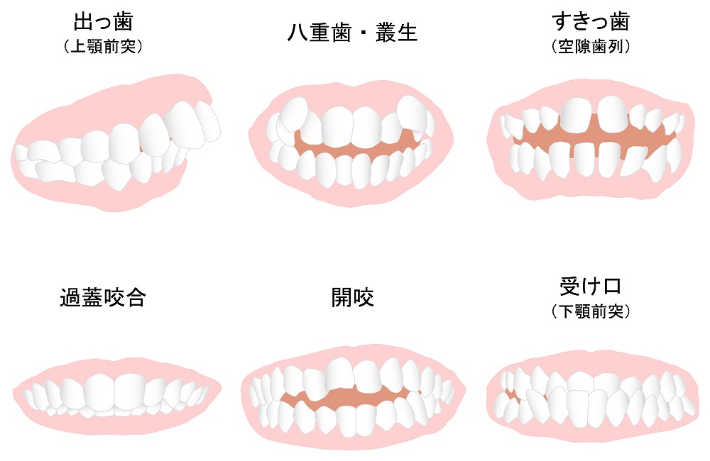 幅広い症例に対応できる