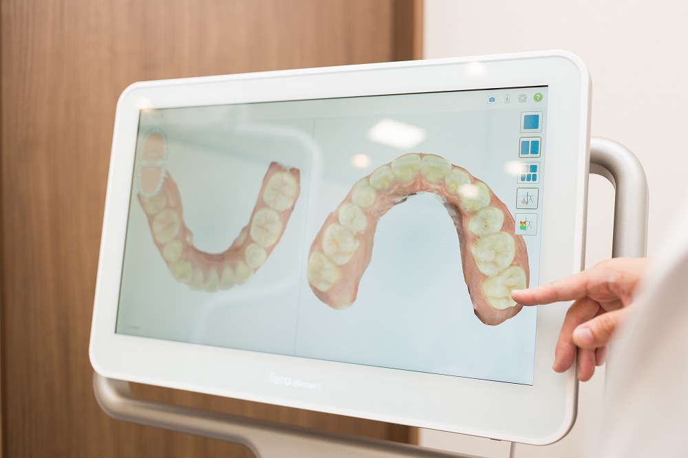矯正後の歯並びをシミュレーションできる