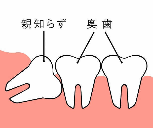 親知らず